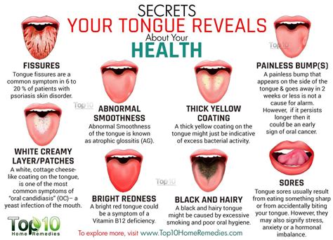 10 Secrets Your Tongue Reveals About Your Health Top 10 Home Remedies 10 Secrets Your Tongue Reveals About Your Health Top 10 Home Remedies