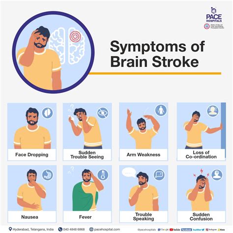 Brain Stroke Types Causes Symptoms Prevention And Treatment
