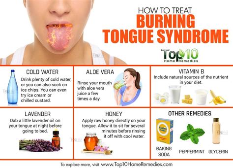 Burning Tongue Syndrome Symptoms Causes Home Remedies And Relief Burning Tongue Syndrome Symptoms Causes Home Remedies And Relief