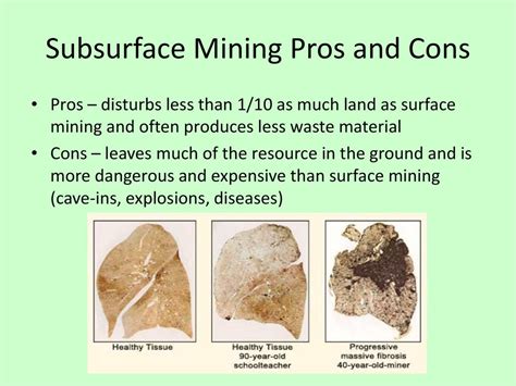 7 Pros And Cons Surface Mining: Quick Guide