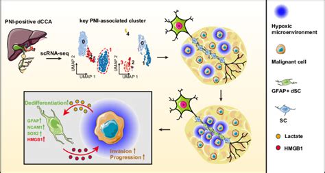 Single Cell Analysis Reveals That Gfap Dedifferentiated Schwann Cells Promote Tumor Progress In Pni Positive Distal Cholangiocarcinoma Via Lactate Hmgb1 Axis Cell Death Disease Single Cell Analysis Reveals That Gfap Dedifferentiated Schwann Cells Promote Tumor Progress In Pni Positive Distal Cholangiocarcinoma Via Lactate Hmgb1 Axis Cell Death Disease